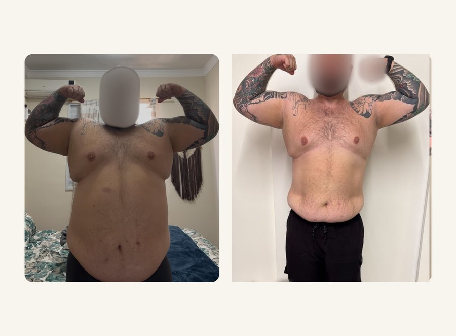 Antes e depois — resultado do Programa Emagrecer com Saúde