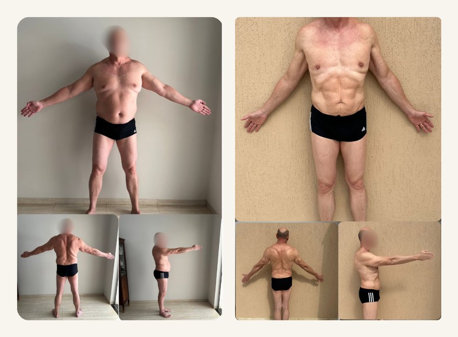 Antes e depois — resultado do Programa Emagrecer com Saúde