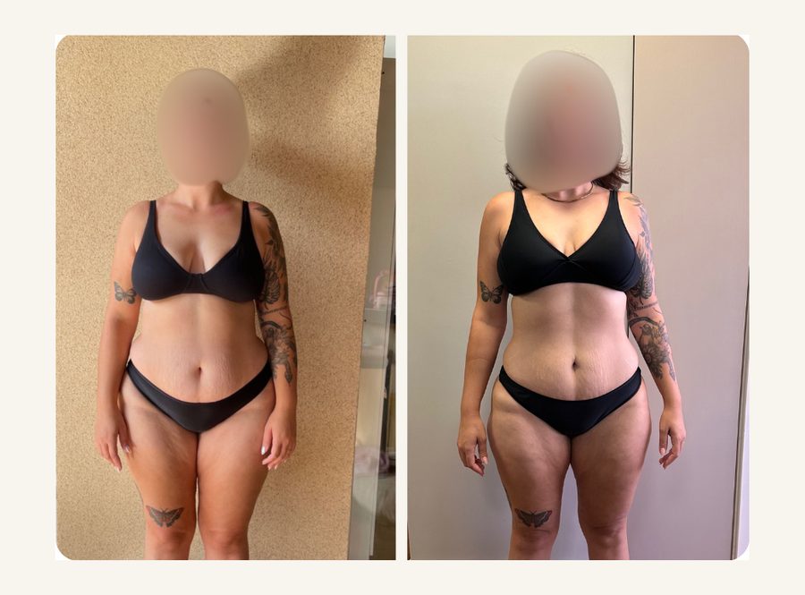 Antes e depois — resultado do Programa Peso Ideal